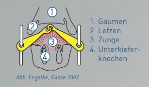 einfach_gebrochen_gebiss